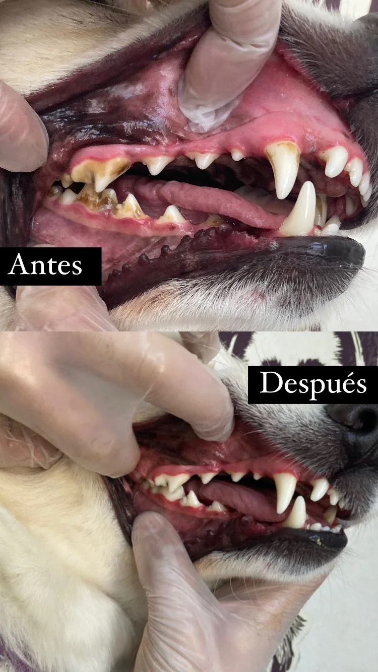Antes y después dental 8
